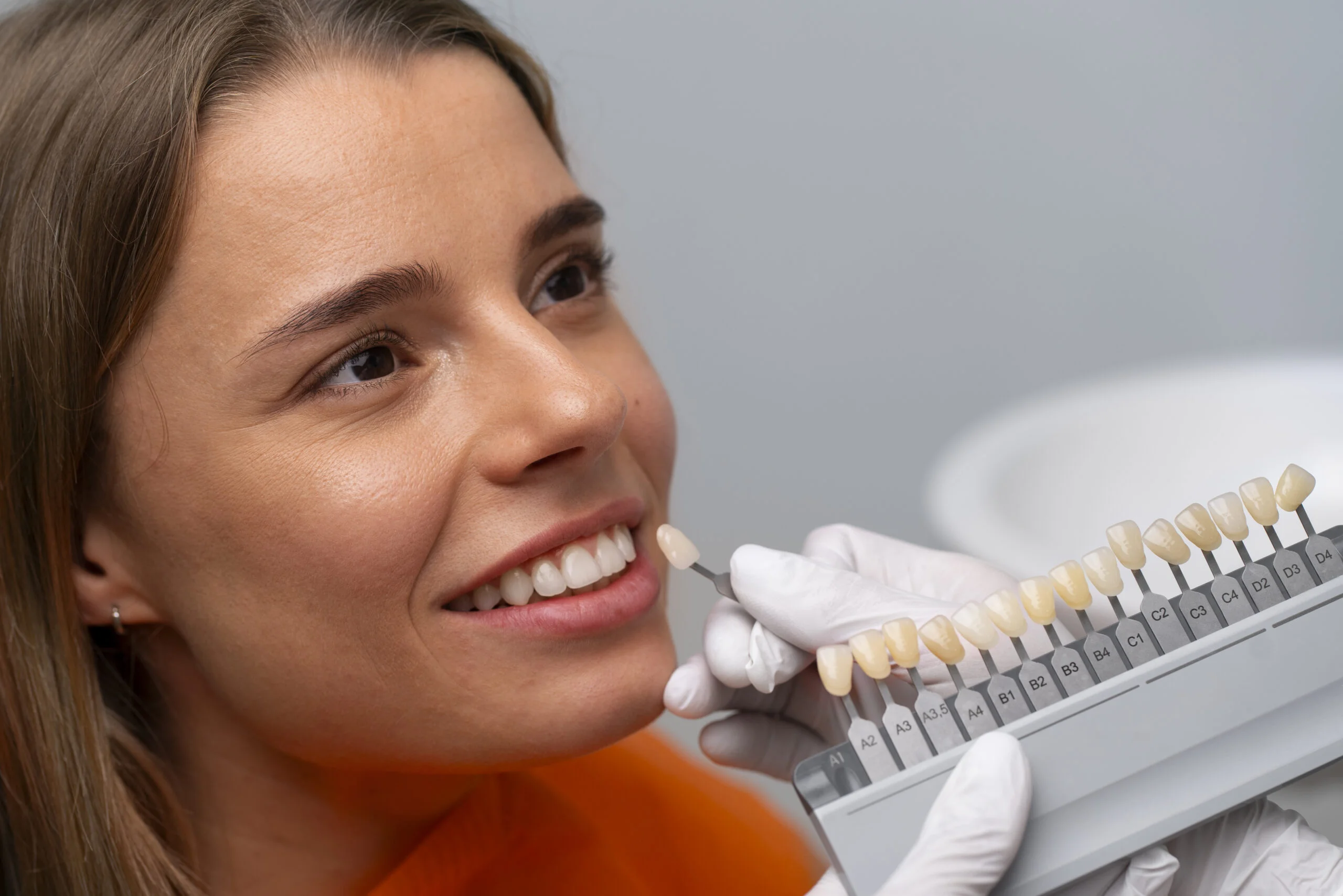 carillas dentales estetica dental